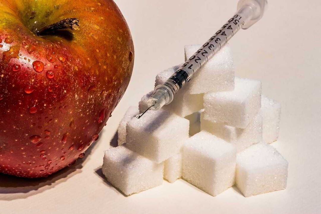 Diabetes mellitus ontwikkelt zich tegen de achtergrond van het gebrek aan insuline en verhoogde glucose in het bloed